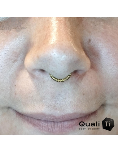 Anneau segmenté en titane QualiTi pyramidal, ouverture facile