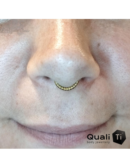 Anneau segmenté en titane QualiTi pyramidal, ouverture facile