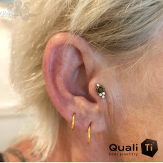 Accessoire QualiTi en titane et zircons premiums, pour 1 ou 1.2 mm 2