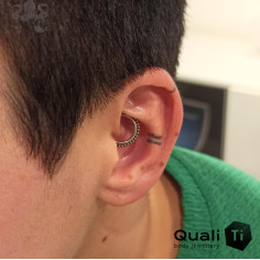 Anneau segmenté en titane QualiTi 2