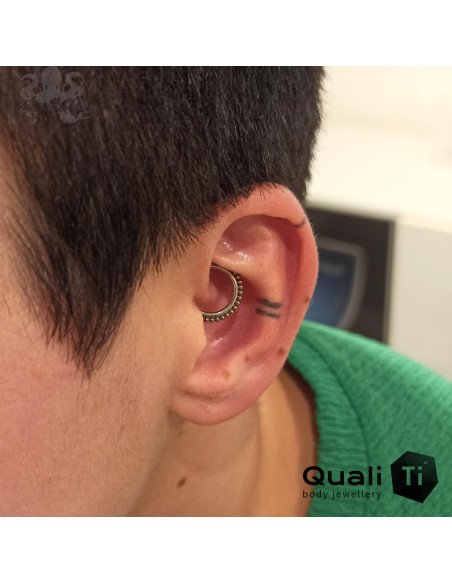 Anneau segmenté en titane QualiTi