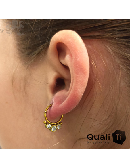 Anneau segmenté en titane QualiTi , ouverture facile