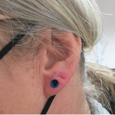 Tunnel en acier chirurgical anodisé bleu 2