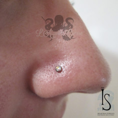 Barre de Labret IS 1 mm pas de vis interne 2