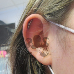 Accessoire QualiTi en titane - pour 1.2 mm 2