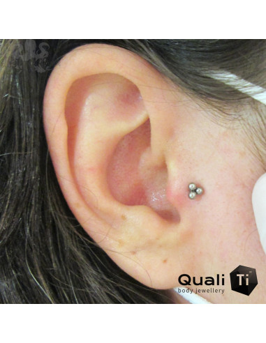 Trio de billes QualiTi en titane - pour 1.2 mm